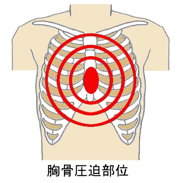 胸骨圧迫部位の画像
